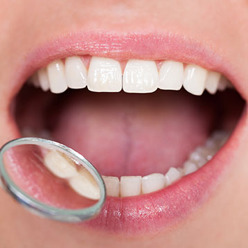 Dental Hygiene & Preventative Care | Acora Dental | General & Family Dentist | NW Calgary