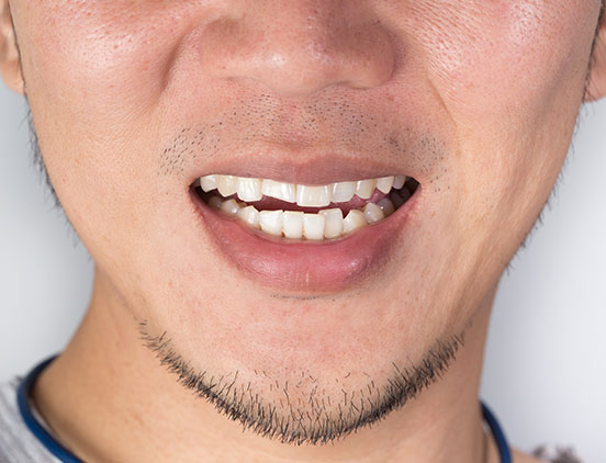 Orthodontics | Acora Dental | General & Family Dentist | NW Calgary