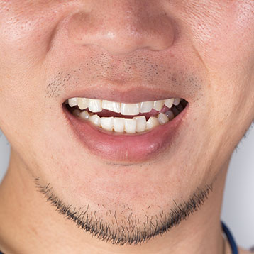 Orthodontics NW Calgary | Acora Dental | General & Family Dentist | NW Calgary