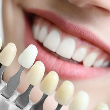 NW Calgary Porcelain Veneers | Acora Dental | General & Family Dentist | NW Calgary