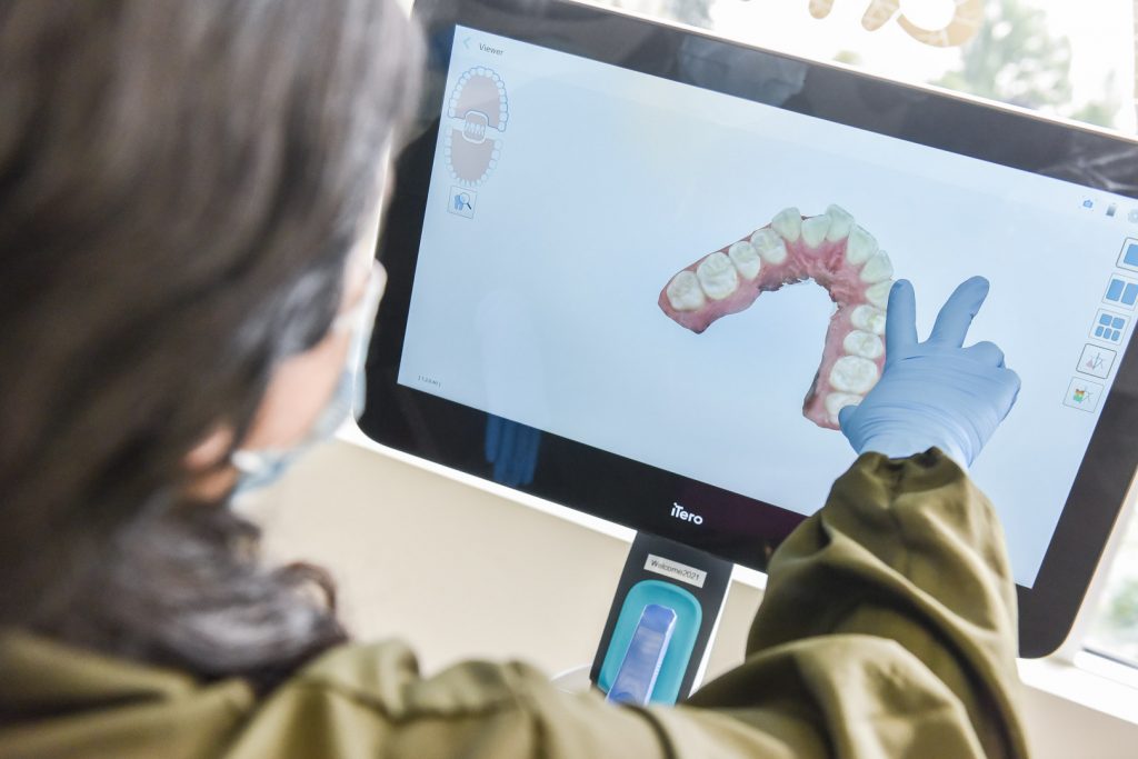 iTero 3D Digital Imaging | Acora Dental | General & Family Dentist | NW Calgary