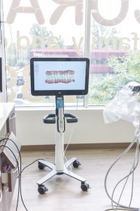 iTero 3D Digital Imaging | Acora Dental | General & Family Dentist | NW Calgary